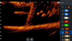 Sonda LiveSight pre sonary LOWRANCE